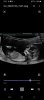 Screenshot_20220127-155725_Video Player.jpg