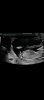 Screenshot_20220127-130107_Video Player.jpg