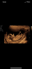 7F7A07C7-D14B-4AFF-978E-55A6DB772B84.png