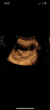 B400279A-E821-4392-86C3-D97BB8B032BF.png