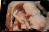 Visser_Gaya_van_der_Helm_baby_202202050027.jpg