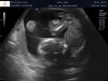 Visser_Gaya_van_der_Helm_baby_202202050017.jpg