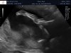 Visser_Gaya_van_der_Helm_baby_202202050014.jpg