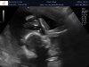 Visser_Gaya_van_der_Helm_baby_202202050012.jpg