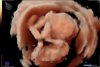 Visser_Gaya_van_der_Helm_baby_202202050046.jpg