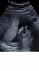 57870EFC-F93A-465E-80F7-E0D4E19322C1.png