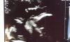 5775AE25-9D50-49CB-95A5-A498D4A434ED.jpeg