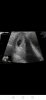 Screenshot_20220228_100127_com.tricefy.patients.jpg