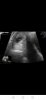 Screenshot_20220228_100124_com.tricefy.patients.jpg