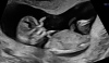12w6d_1.png