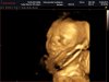 Baby Beumer 1.jpg