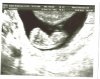 echo 2 001.jpg