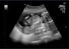 baby.jpg