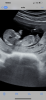 59EDF6C0-64B6-4DB8-92FD-C62BE8259392.png