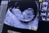 baby2.jpeg