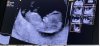 baby.jpeg