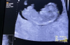 baby3.png