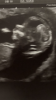 09CFCB5C-809E-4A15-B752-3B452EEACC27.png