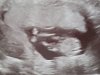 20220405_100756.jpg