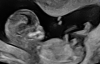 12w6d_2.png