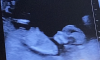 Schermafbeelding 2022-04-13 om 12.57.54.png