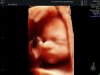 fotobaby.jpg