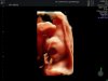 fotobaby2.jpg
