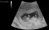 upload_2022-4-28_11-15-33.jpeg