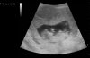 upload_2022-4-28_11-16-18.jpeg