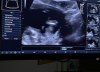 265AFBDE-8C29-4997-9686-4CE80DD58D79.jpeg