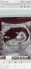 Screenshot_20220517-171434_Gallery.jpg