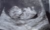 525682DE-A2E5-4630-BD10-E529645A0A9D.jpeg