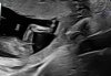 90EAB978-D801-4A85-A241-425EBB488B69.jpeg