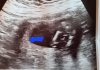 20220704_074055.jpg