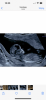 905CEF6C-6309-4C4A-9752-F765D17C2FAA.png
