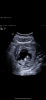 26FB4805-B09B-4449-B12E-731E4AFF73C4.png
