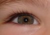 oog.jpg