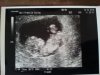 64072-albums12688-picture79975.jpg