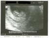 echo 21-6 11wkn ZP.jpg