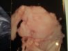 3D-echo2_zps82452cac.jpg