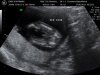 BABY KOOPMANS_12.jpg