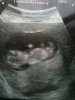 echo12wk.jpg