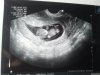 echo 26-6-2013.jpg