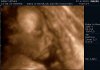 13-06-27-093406_BABY MONES_20130627_093406_0010.jpg