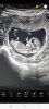 Screenshot_20220718-100106_PicsArt.jpg