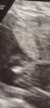 523E0C69-0210-4E3C-AEDF-1546C11B8B45.png