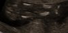 20220803_110646.jpg