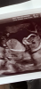 A0716CBE-3B7D-4272-8EC4-933D05BEFAAD.png