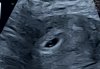20220827_113443.jpg