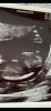 05C68B42-C65B-4C99-A856-9C7E1E266A1C.png
